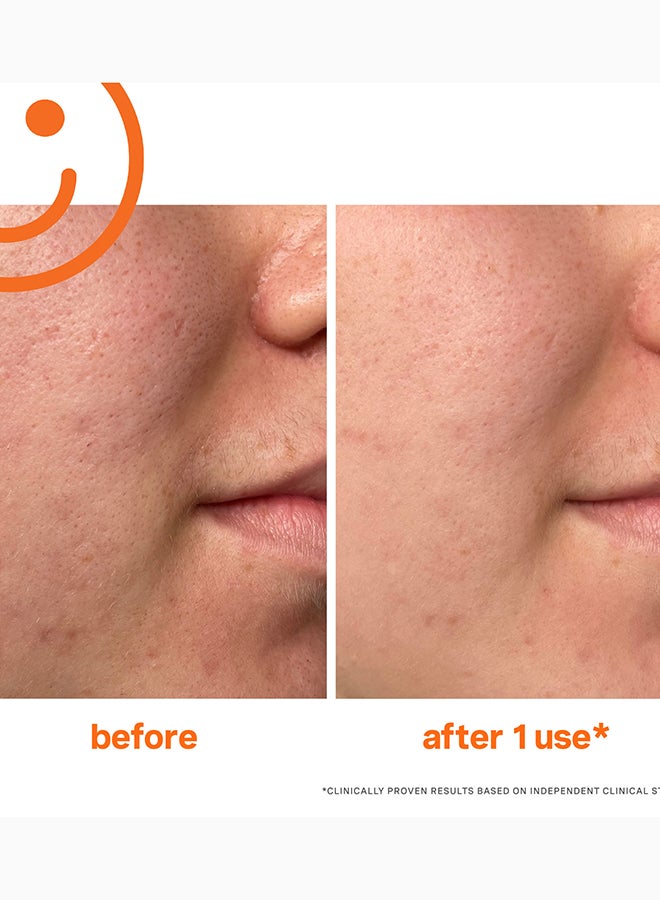Kate Somerville ExfoliKate Intensive Exfoliating Treatment 60ml – Resurfacing Facial Scrub for Smooth Skin - Image 3